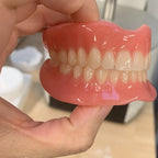 Comfort Fit Cosmetic Teeth Veneers for Instant Smile Makeover