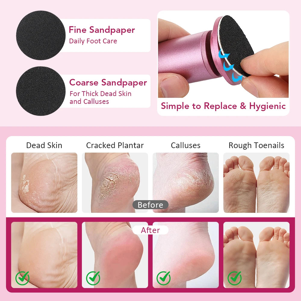 Electric Callus Remover for Smooth Heels