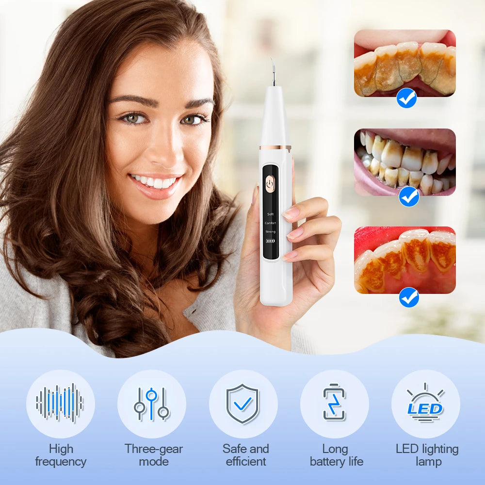 Ultrasonic Electric Teeth Cleaner and Tartar Remover