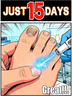Laser Nail Fungus Treatment Device for Home Use