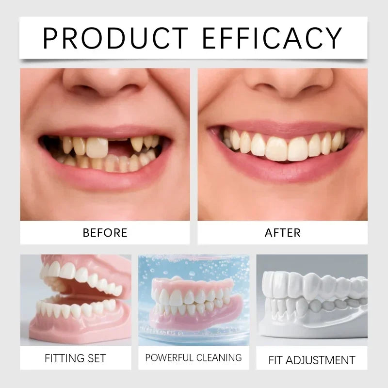 Temporary Cosmetic Denture Set for Instant Smile Restoration - 5