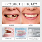 Temporary Cosmetic Denture Set for Instant Smile Restoration