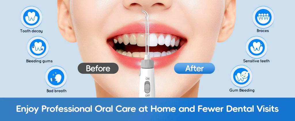 Electric Water Flosser for Teeth with 8 Multi-Function Nozzles