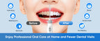 Electric Water Flosser for Teeth with 8 Multi-Function Nozzles
