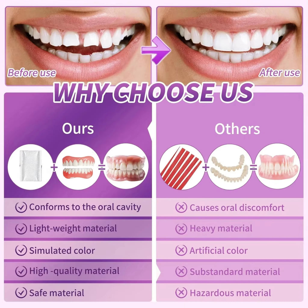 Custom Fit Cosmetic Denture Set for Instant Natural Smile