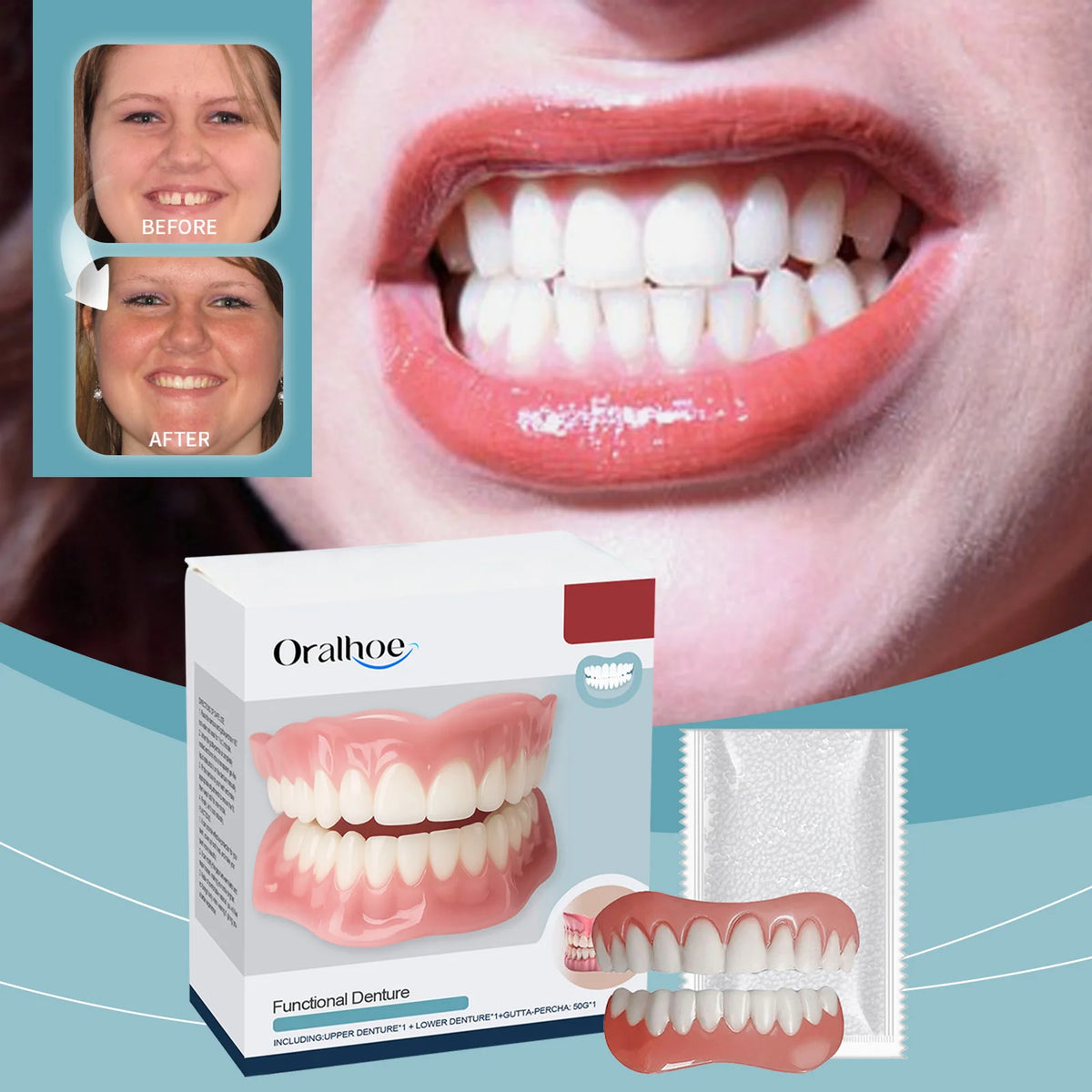 Temporary Silicone Denture and Smile Repair Kit