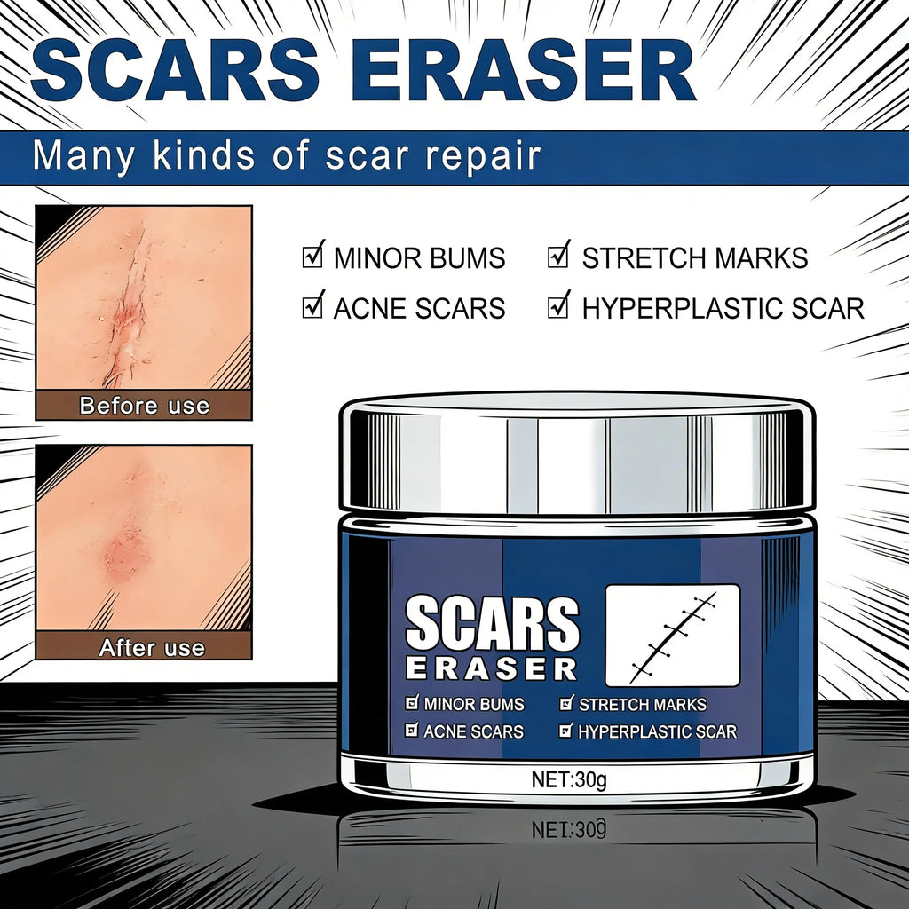 Scar Removal Cream for Acne Marks and Stretch Marks