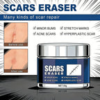 Scar Removal Cream for Acne Marks and Stretch Marks