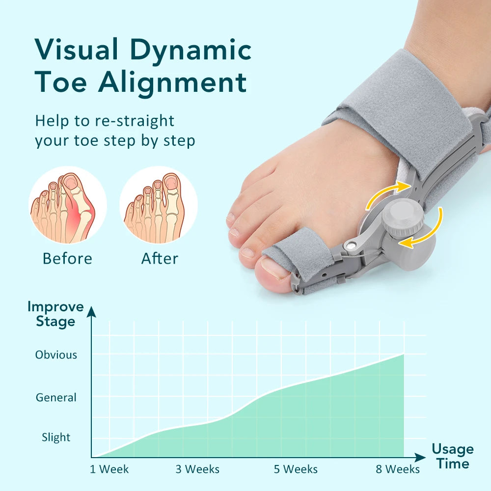 Adjustable Bunion Corrector and Toe Straightener for Foot Alignment - 16