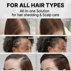 Scalp Nourishing Hair Growth Serum with Integrated Massager