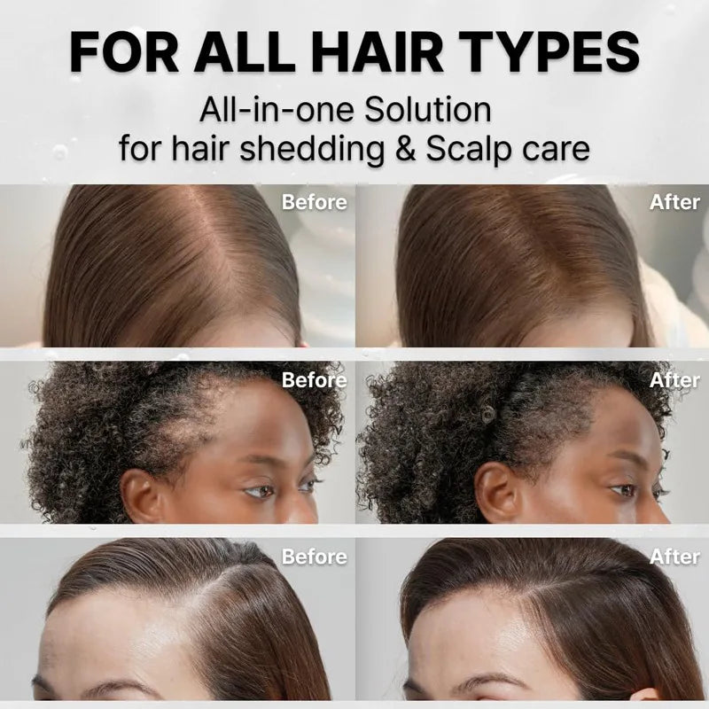 Scalp Nourishing Hair Growth Serum with Integrated Massager