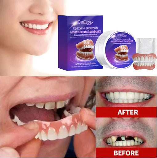 Comfortable Snap-On Cosmetic Dentures for a Natural Smile - 1