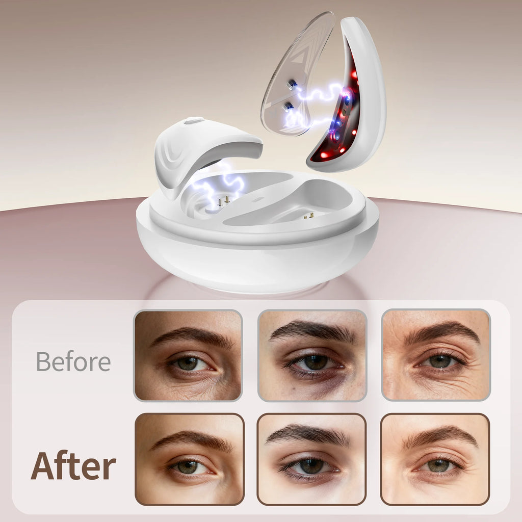 Red Light Microcurrent Under-Eye Massager for Dark Circles