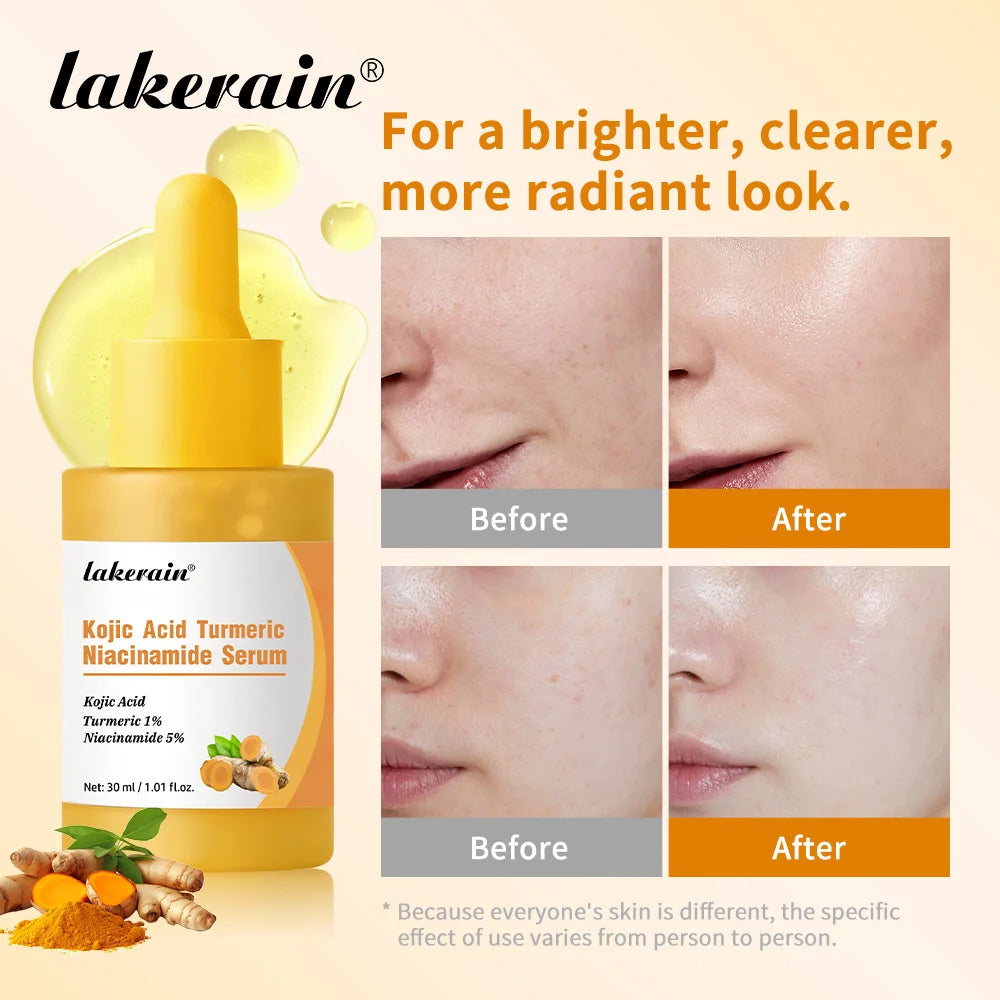 Brightening Kojic Acid and Turmeric Face Serum - 4