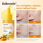 Brightening Kojic Acid and Turmeric Face Serum