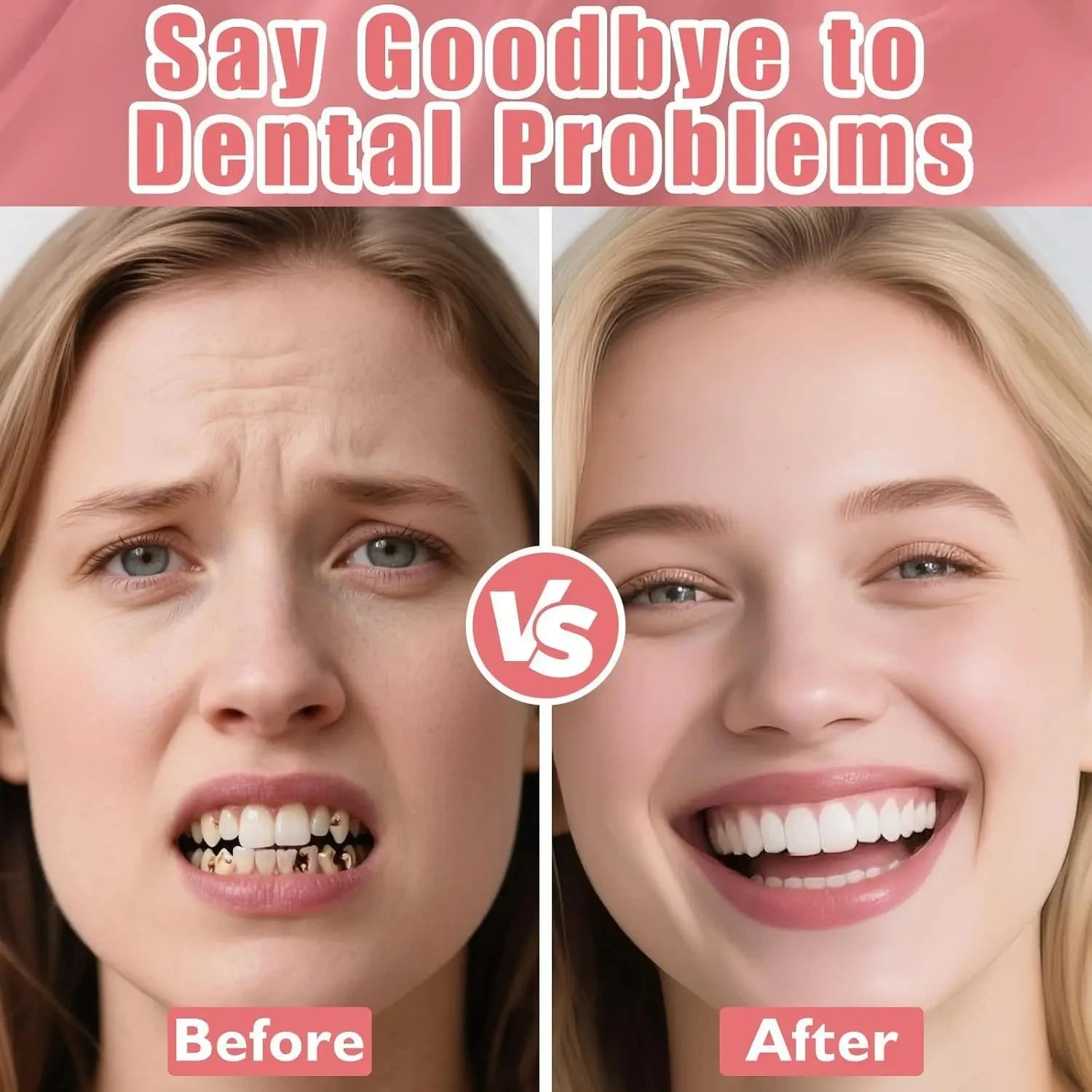 Temporary Denture Fitting and Dental Retouching Kit - 4