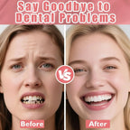 Temporary Denture Fitting and Dental Retouching Kit