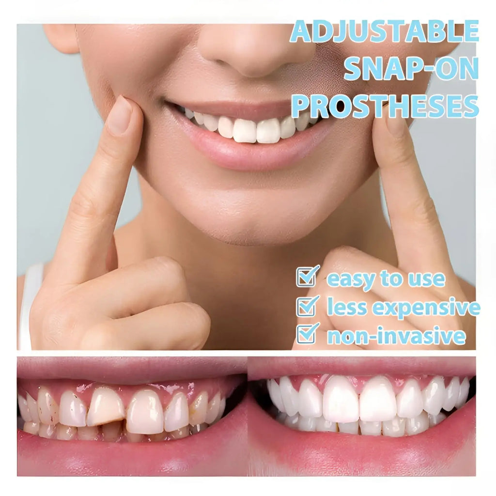 Instant Snap-On Temporary Dentures for Smile Correction