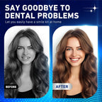 Instant Cosmetic Denture Set for Natural Looking Smile