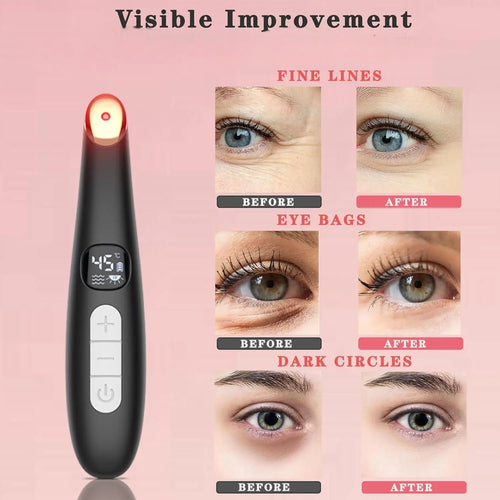 3-in-1 Heated Eye and Face Rejuvenation Wand