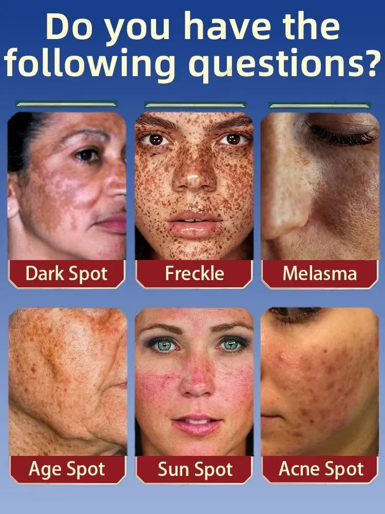 Dark Spot Correcting Facial Serum for Radiant Skin - 3