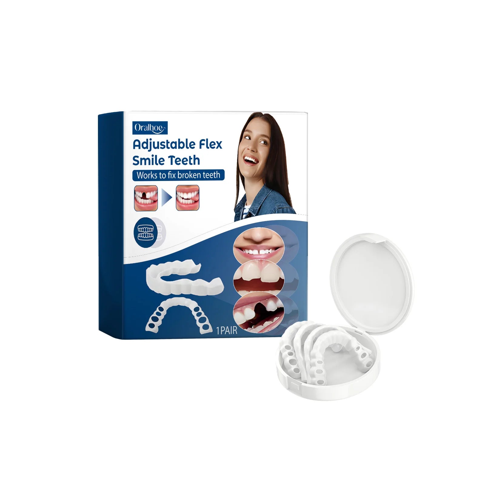 Adjustable Snap-On Dentures for Instant Smile Repair - 21
