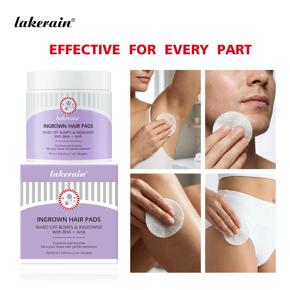 Exfoliating Ingrown Hair Treatment Pads for Razor Bumps