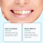 Refreshing Mint Foam Cleaner for Dental Aligners and Retainers