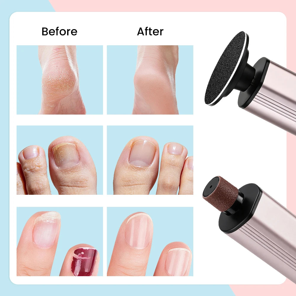 Electric Rechargeable Foot Callus Remover with 9 Speed Settings