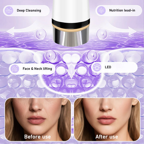 4-Mode Microcurrent Facial Lifting and Skin Tightening Device