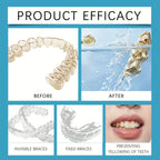 Effervescent Denture Cleaning Tablets - 12 Piece Deep Clean Kit