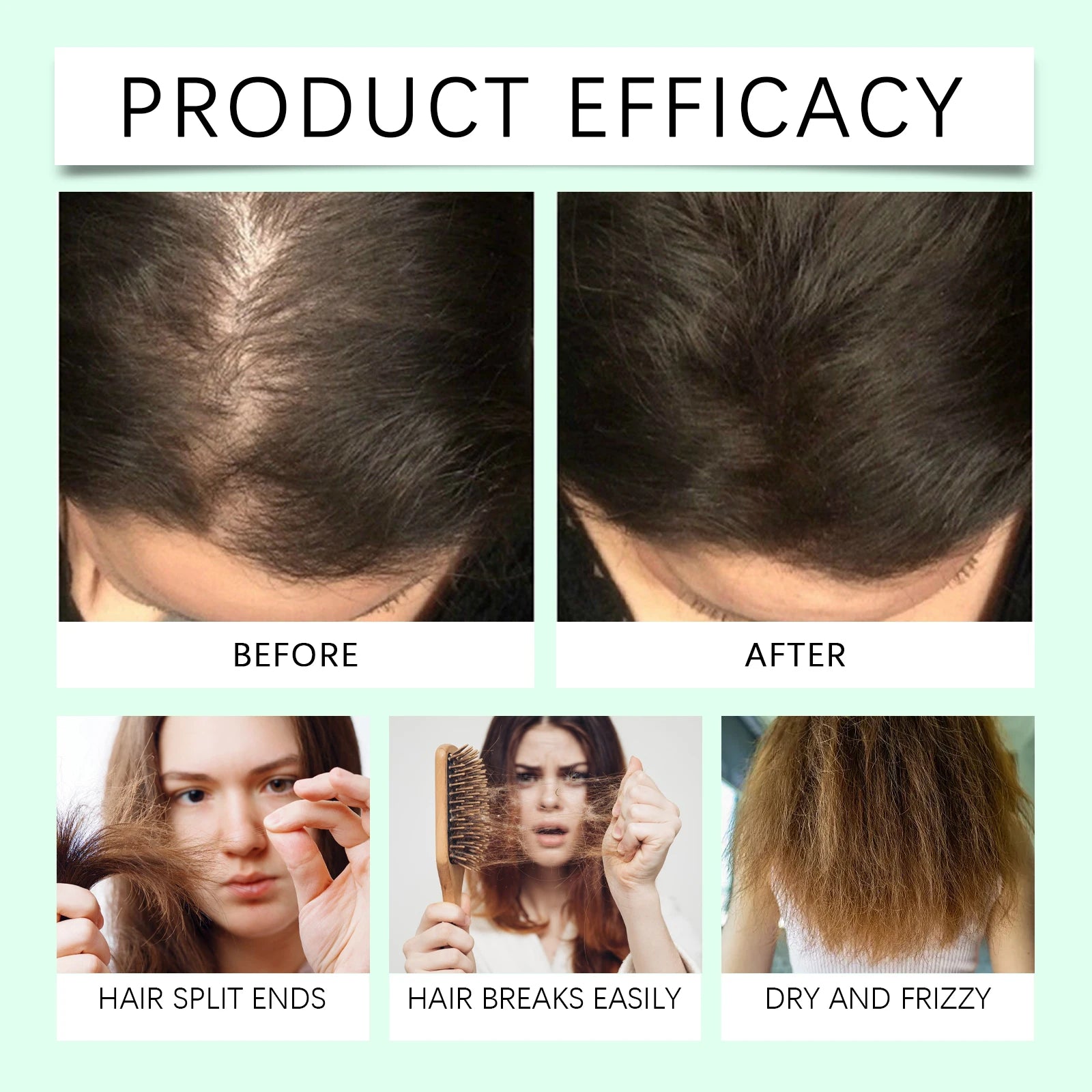 Rosemary Hair Growth Oil for Scalp and Thinning Hair - 4