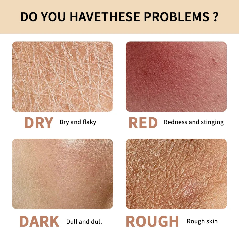 Deep Hydrating Hydrogel Facial Cream for Nourished Skin - 6