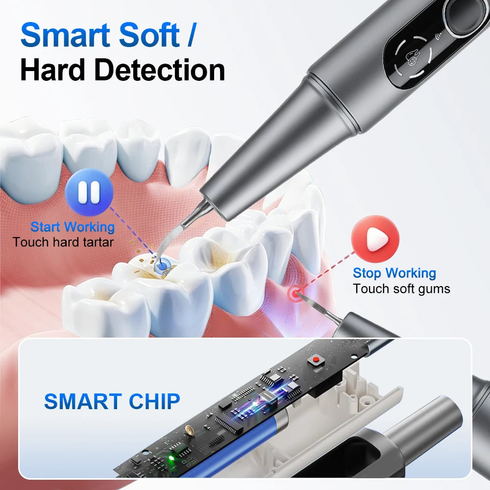 Visual Ultrasonic Tooth Cleaner with HD Camera