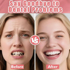 Adjustable Cosmetic Denture Set for Instant Smile Enhancement