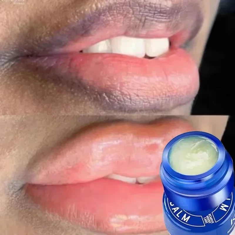 Moisturizing Lip Lightening Balm for Dark Lips and Exfoliating Repair