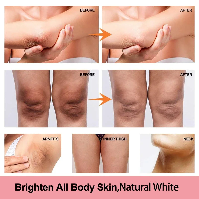 Vitamin C Brightening Cream for Dark Spots and Underarms