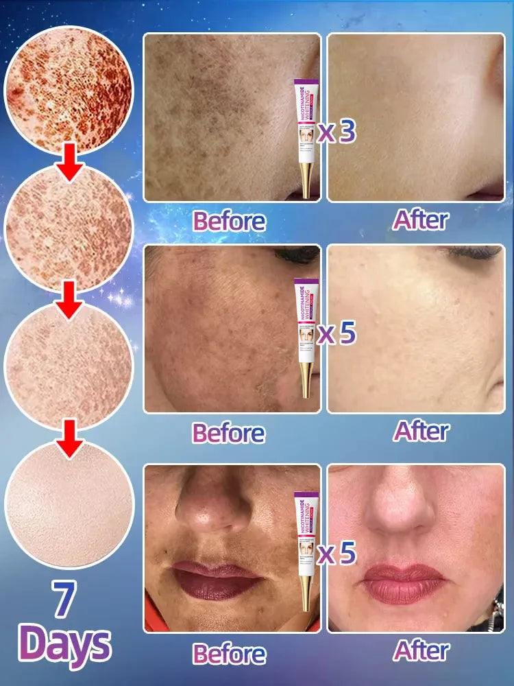 Dark Spot Correcting Facial Serum for Radiant Skin