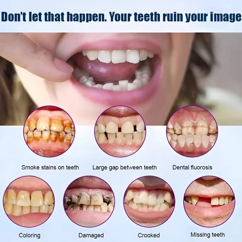 Realistic Full Set Upper and Lower Dentures for Natural Smile