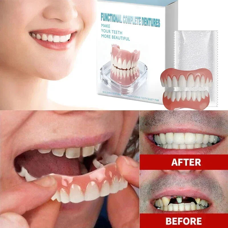 Instant Cosmetic Smile Veneers for Missing or Stained Teeth - 1