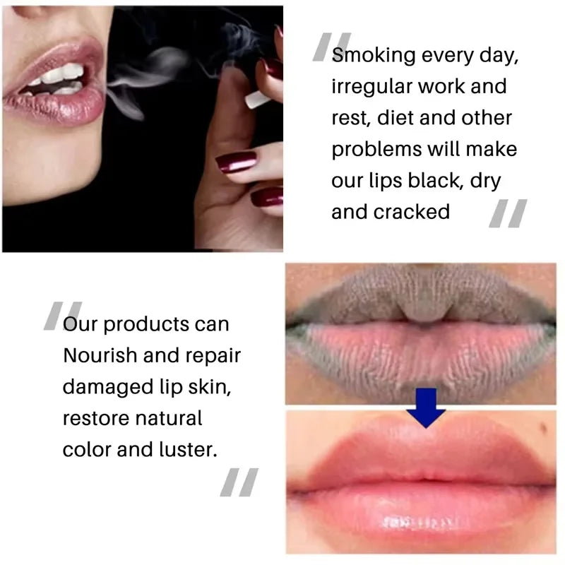 Moisturizing Lip Lightening Balm for Dark Lips and Exfoliating Repair - 6