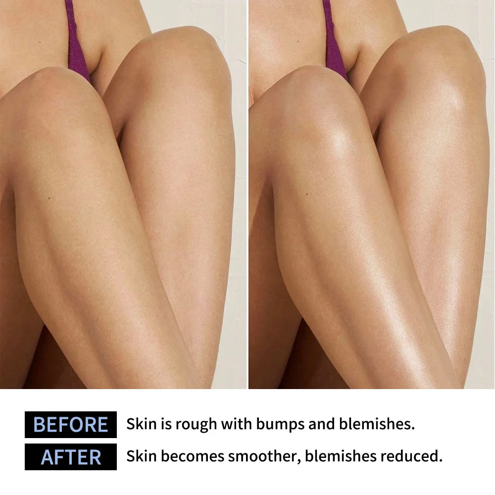 Glycolic Acid Exfoliating Body Stick for Smooth Skin - 4