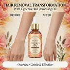Cyperus Herbal Oil for Hair Growth Inhibition and Skin Soothing