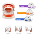 3-Stage Adult Orthodontic Teeth Trainer Alignment Mouthpiece