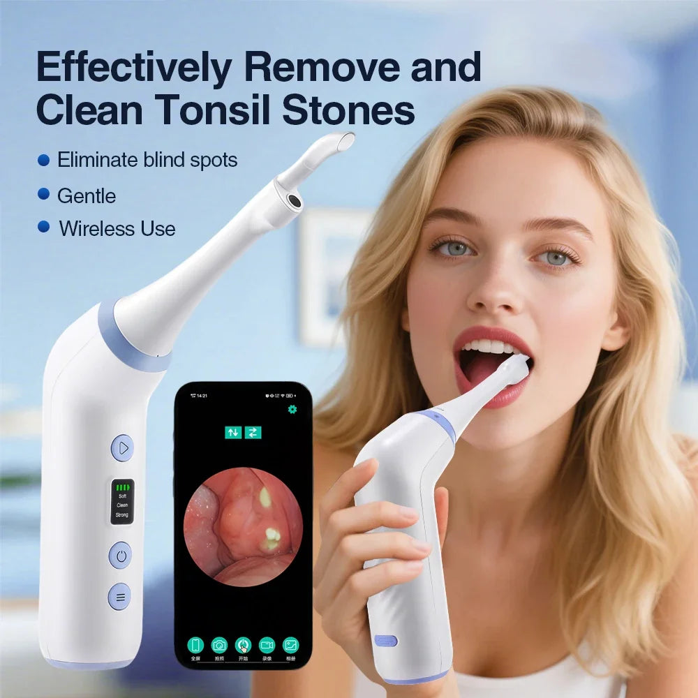 HD Visible Tonsil Stone Remover Vacuum Kit - 1