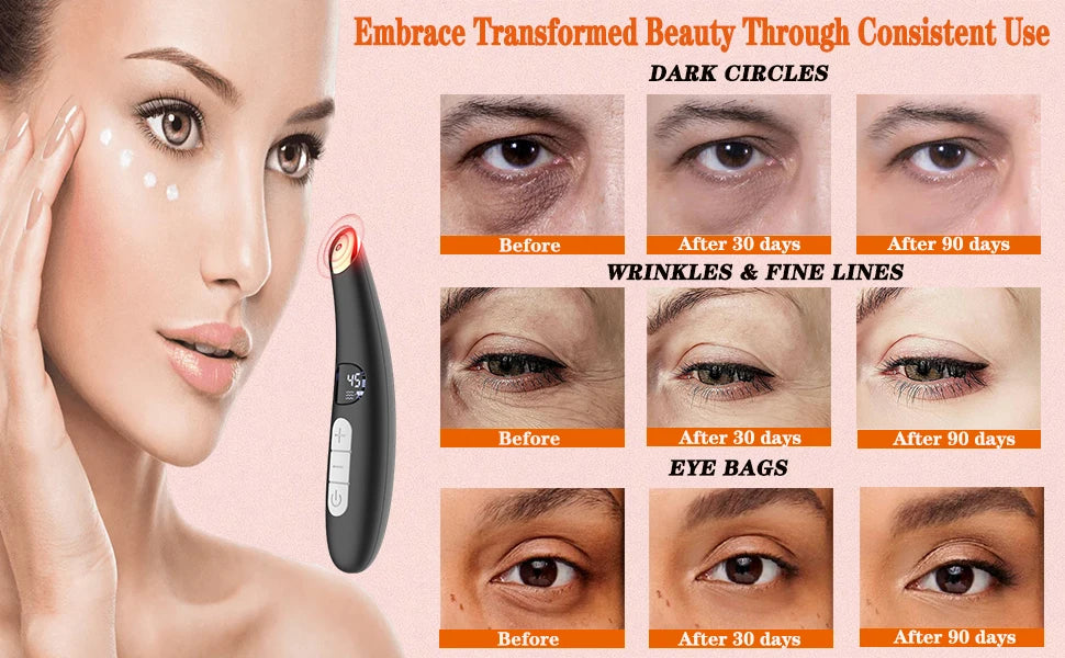 3-in-1 Heated Eye and Face Rejuvenation Wand