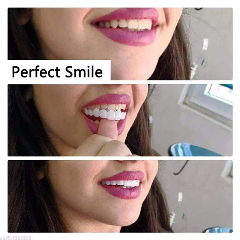 Snap-On Temporary Smile Veneers for Men and Women