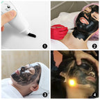 Carbon Laser Gel for Facial Deep Pore Cleansing and Skin Rejuvenation