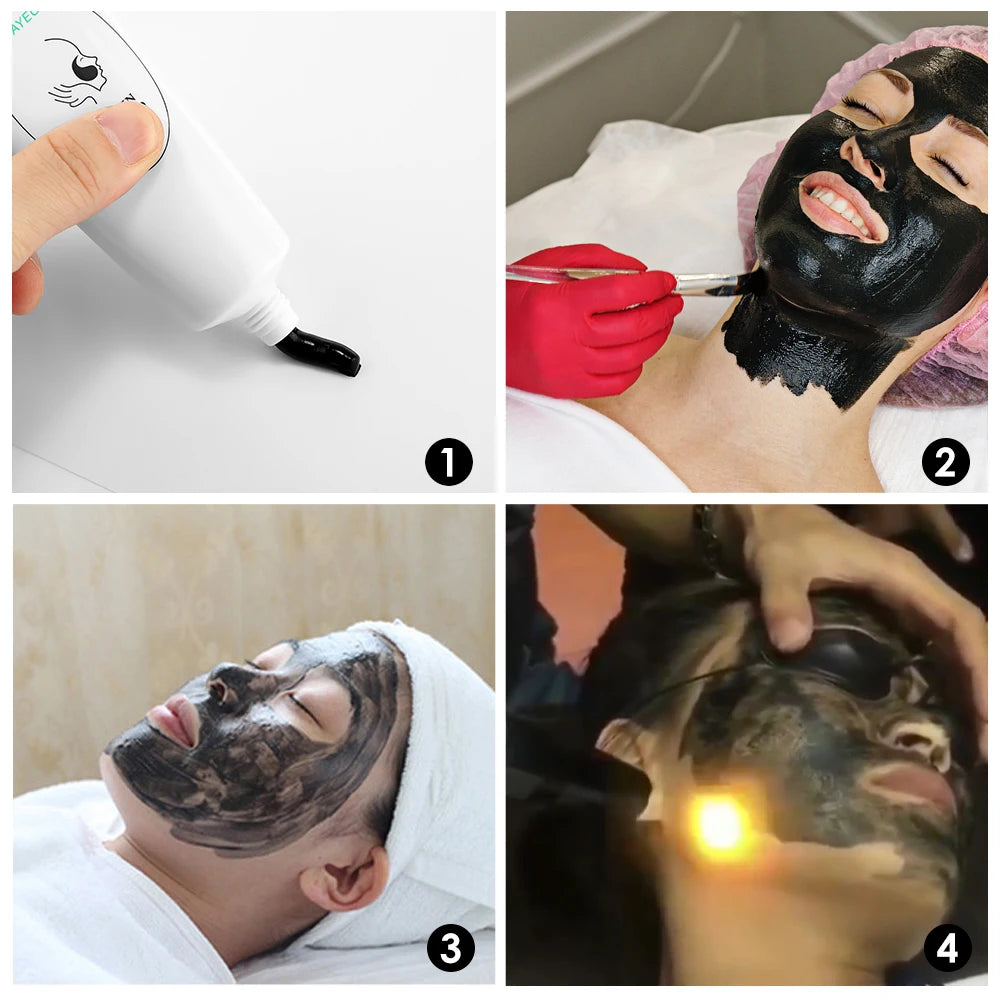 Carbon Laser Gel for Facial Deep Pore Cleansing and Skin Rejuvenation