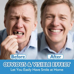 Instant Comfort Cosmetic Denture Set for a Natural Smile
